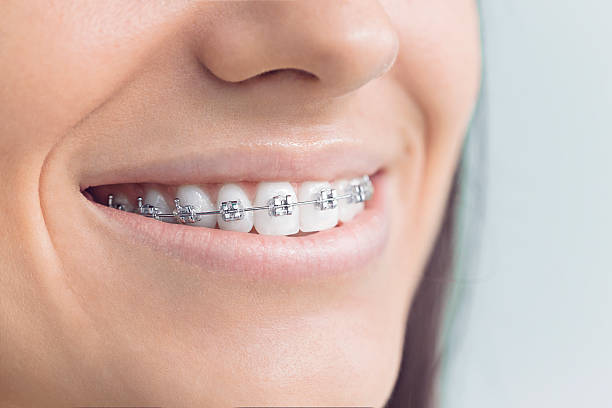 Best Invisalign and Clear Aligners  in Blountstown, FL